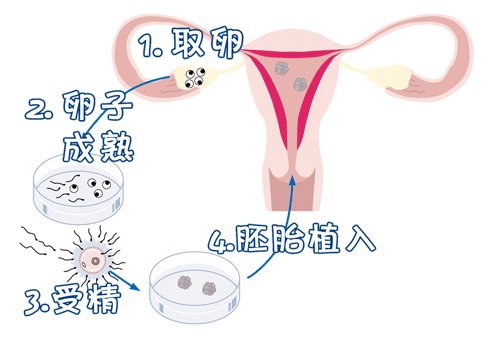 供卵代怀生男宝代生包成功生殖中心